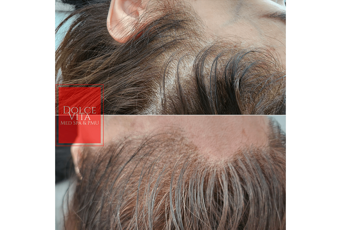 scalp pigmentation before and after